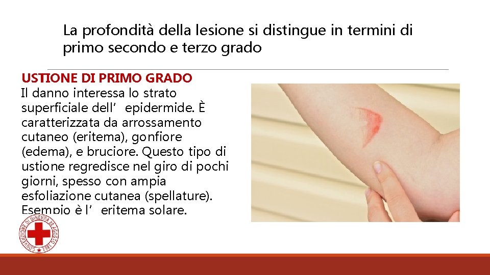 La profondità della lesione si distingue in termini di primo secondo e terzo grado