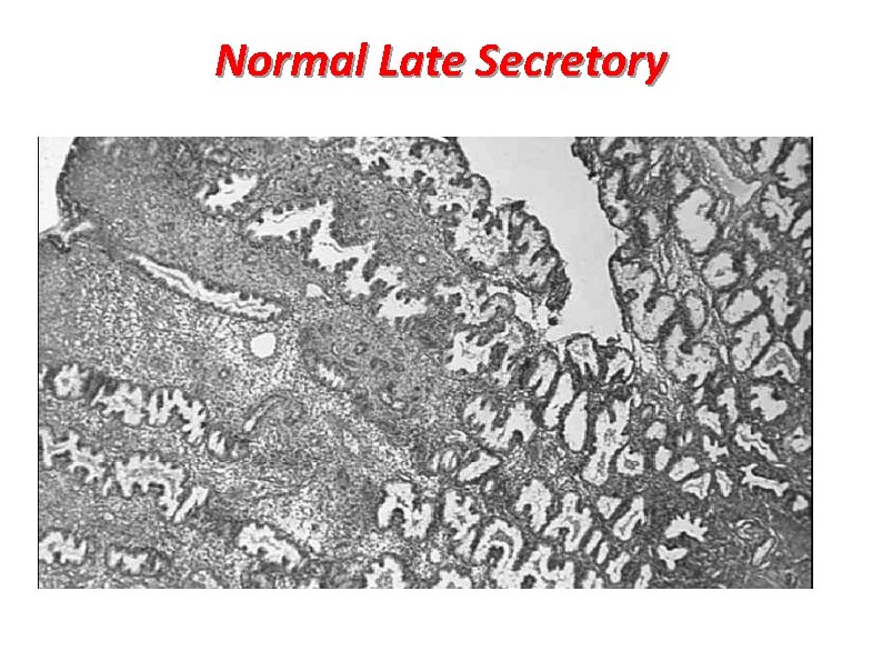 Normal Late Secretory 