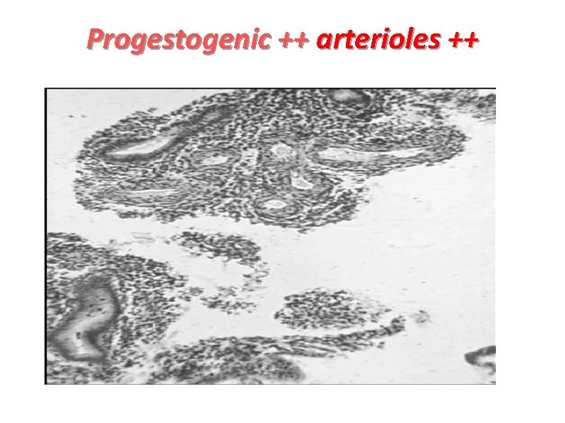 Progestogenic ++ arterioles ++ 