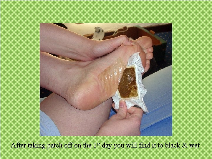 After taking patch off on the 1 st day you will find it to After taking patch off on the 1 st day you will find it to