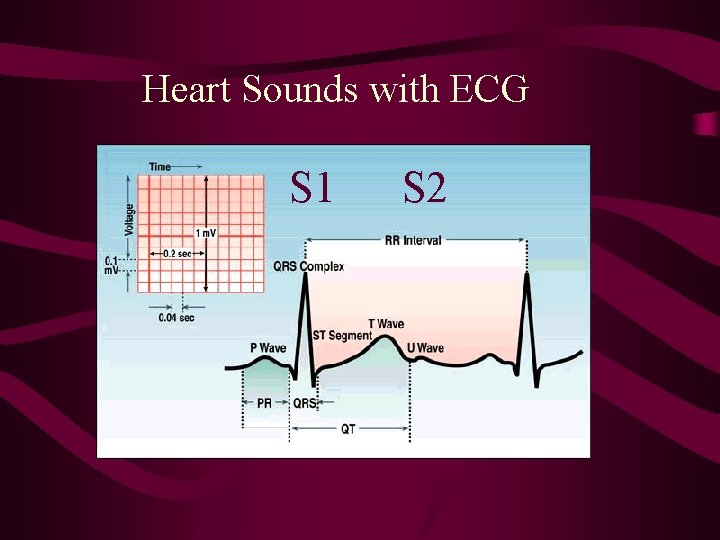 Heart Sounds with ECG S 1 S 2 Heart Sounds with ECG S 1 S 2