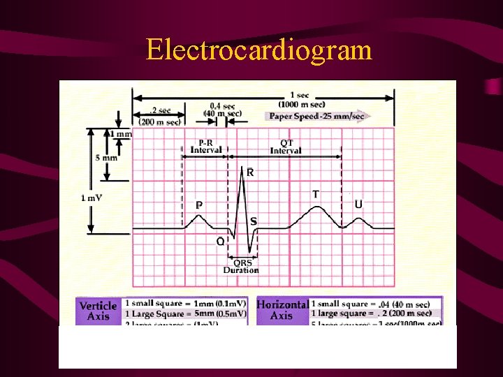 Electrocardiogram Electrocardiogram