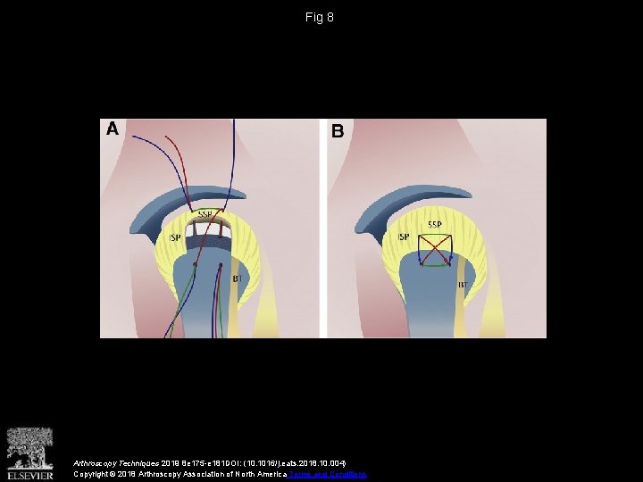Fig 8 Arthroscopy Techniques 2019 8 e 175 -e 181 DOI: (10. 1016/j. eats. Fig 8 Arthroscopy Techniques 2019 8 e 175 -e 181 DOI: (10. 1016/j. eats.