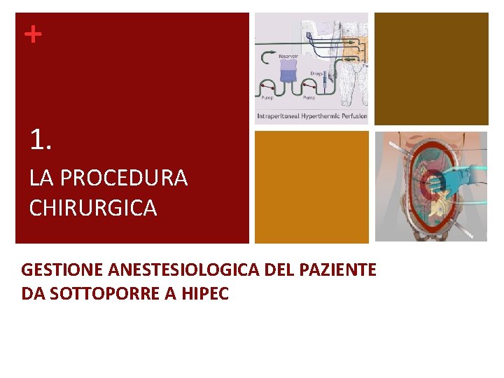 + 1. LA PROCEDURA CHIRURGICA GESTIONE ANESTESIOLOGICA DEL PAZIENTE DA SOTTOPORRE A HIPEC 