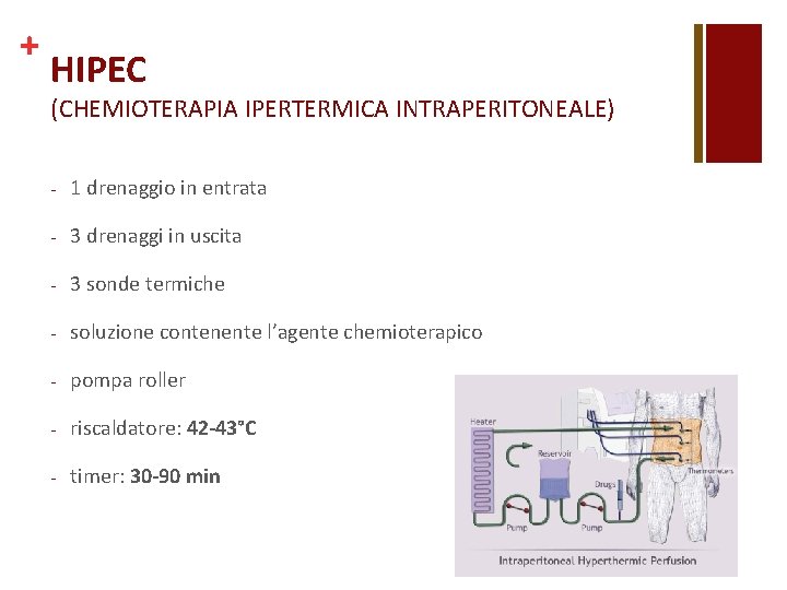 + HIPEC (CHEMIOTERAPIA IPERTERMICA INTRAPERITONEALE) - 1 drenaggio in entrata - 3 drenaggi in