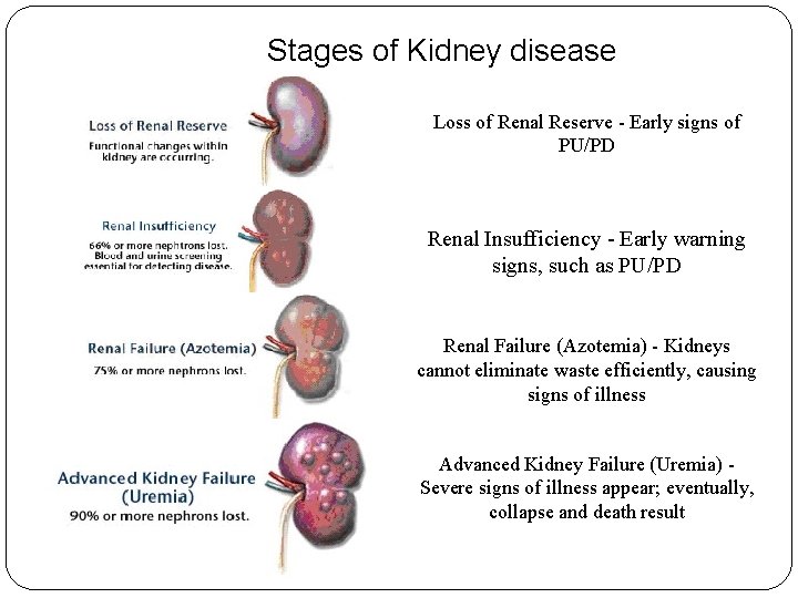 Stages of Kidney disease Loss of Renal Reserve - Early signs of PU/PD Renal