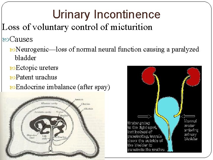 Urinary Incontinence Loss of voluntary control of micturition Causes Neurogenic—loss of normal neural function