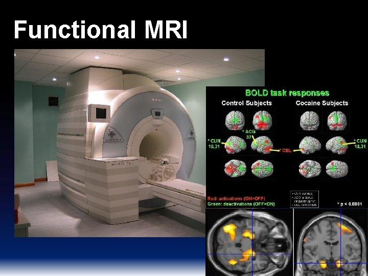 Functional MRI 