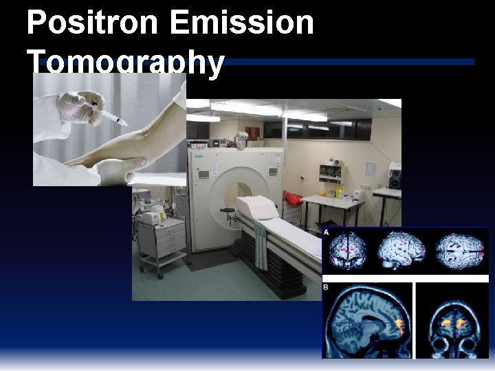 Positron Emission Tomography 