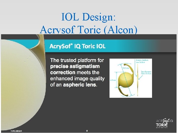 IOL Design: Acrysof Toric (Alcon) IOL Design: Acrysof Toric (Alcon)