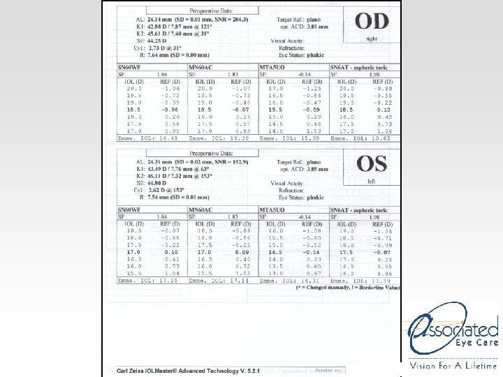 Management of Corneal Astigmatism with Toric IOLs Optimizing