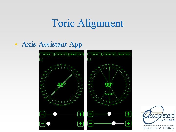 Toric Alignment • Axis Assistant App Toric Alignment • Axis Assistant App