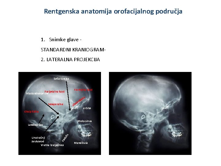 Rentgenska anatomija orofacijalnog područja 1. Snimke glave STANDARDNI KRANIOGRAM 2. LATERALNA PROJEKCIJA Sella turcica