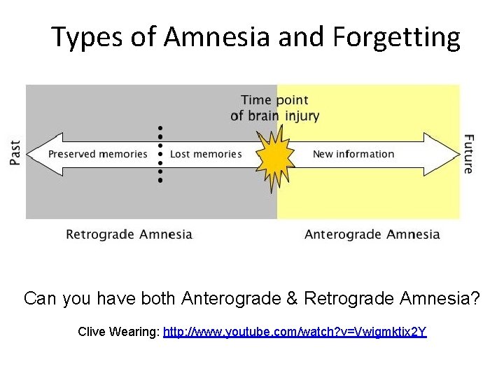 Types of Amnesia and Forgetting Can you have both Anterograde & Retrograde Amnesia? Clive