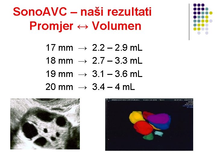 Sono. AVC – naši rezultati Promjer ↔ Volumen 17 mm 18 mm 19 mm