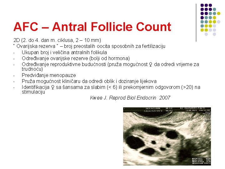 AFC – Antral Follicle Count 2 D (2. do 4. dan m. ciklusa, 2