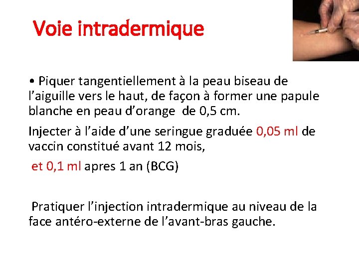 Voie intradermique • Piquer tangentiellement à la peau biseau de l’aiguille vers le haut,