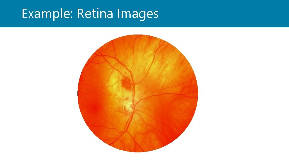 Example: Retina Images 
