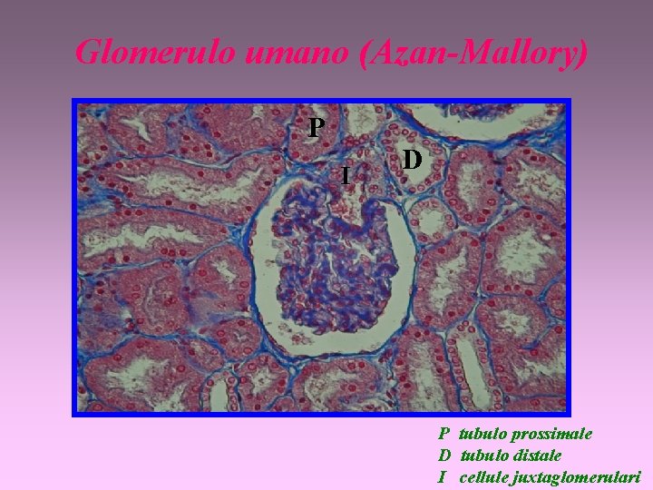 Glomerulo umano (Azan-Mallory) P I D P tubulo prossimale D tubulo distale I cellule