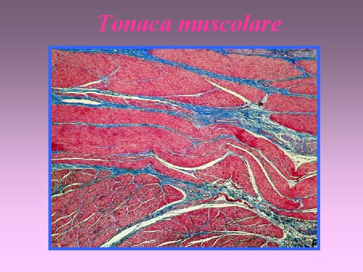 Tonaca muscolare 