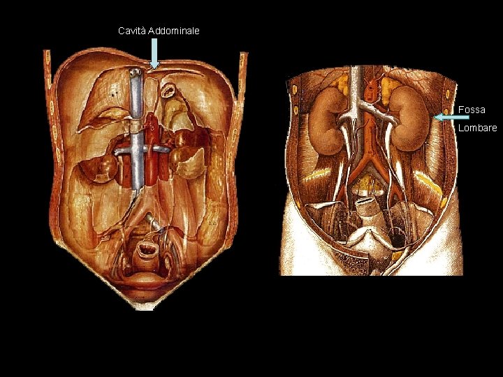 Cavità Addominale Fossa Lombare 