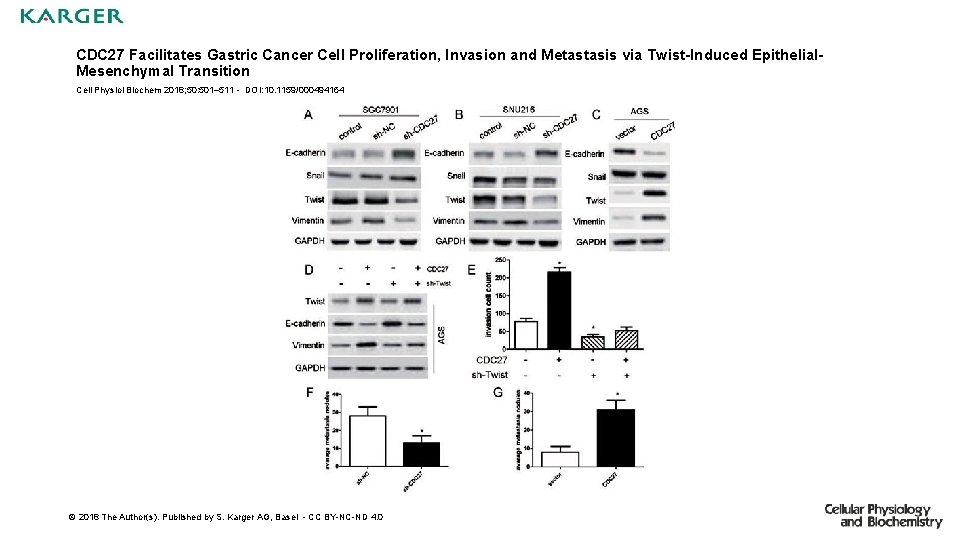 CDC 27 Facilitates Gastric Cancer Cell Proliferation, Invasion and Metastasis via Twist-Induced Epithelial. Mesenchymal