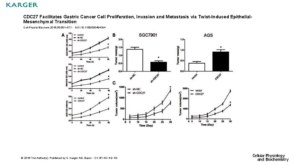 CDC 27 Facilitates Gastric Cancer Cell Proliferation, Invasion and Metastasis via Twist-Induced Epithelial. Mesenchymal