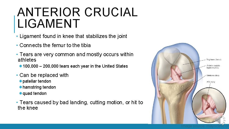 ANTERIOR CRUCIAL LIGAMENT • Ligament found in knee that stabilizes the joint • Connects