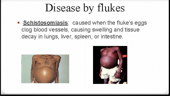 Disease by flukes § Schistosomiasis: caused when the fluke’s eggs clog blood vessels, causing