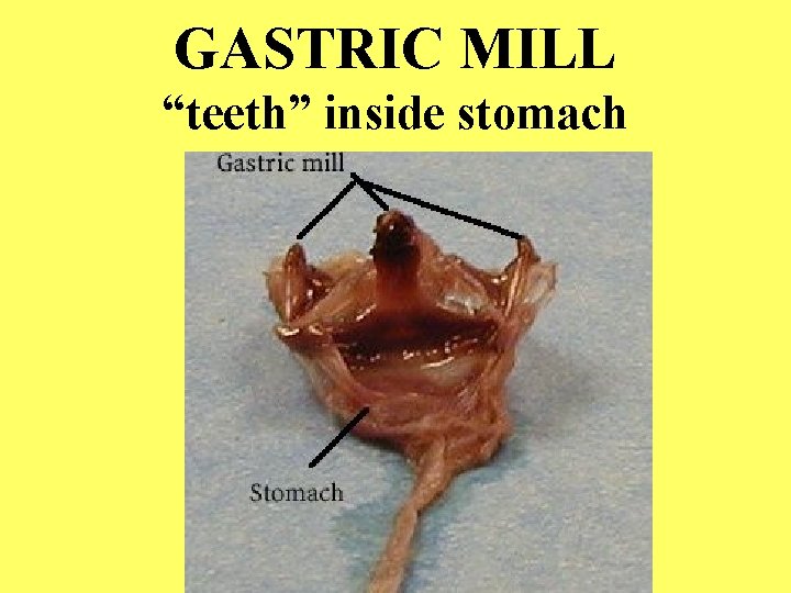 GASTRIC MILL “teeth” inside stomach 