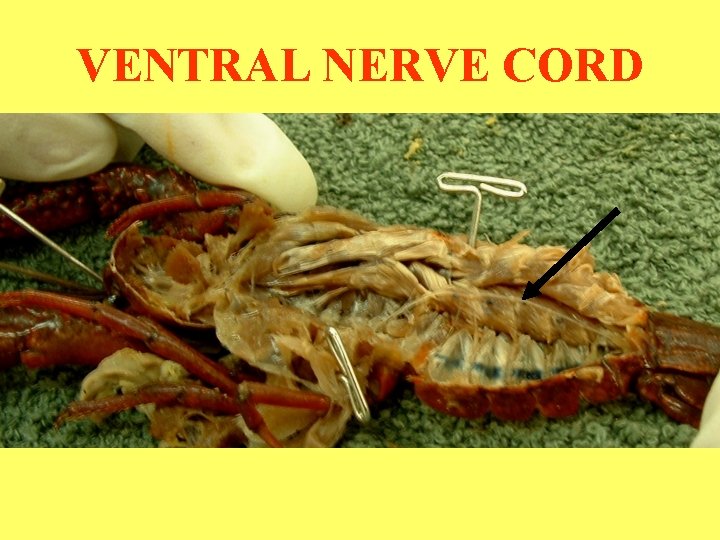 VENTRAL NERVE CORD 