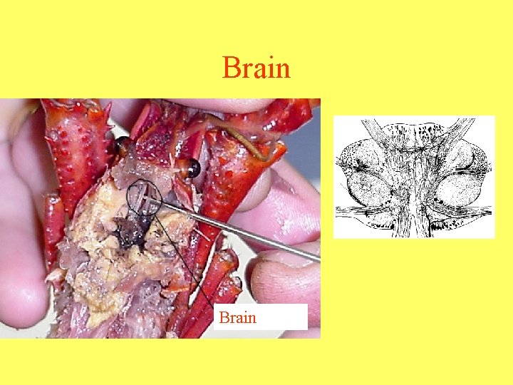 Brain 