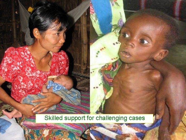 Skilled support for challenging cases 1 49 Skilled support for challenging cases 1 49
