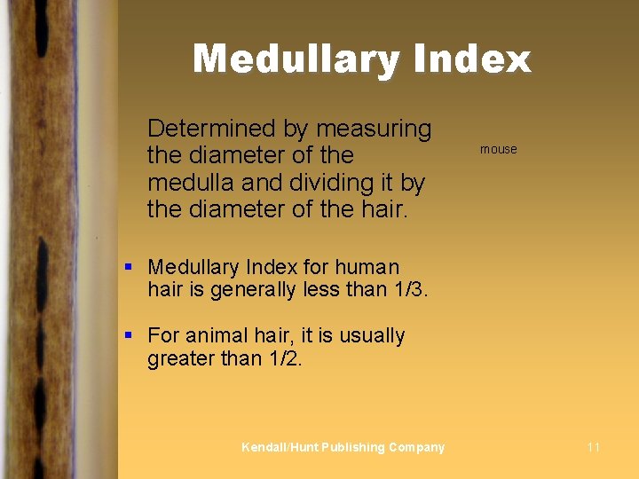 Medullary Index Determined by measuring the diameter of the medulla and dividing it by