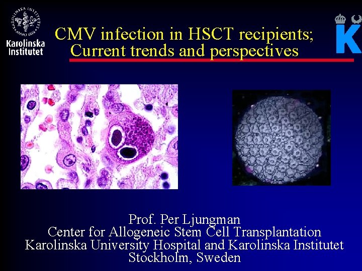 CMV infection in HSCT recipients; Current trends and perspectives Prof. Per Ljungman Center for