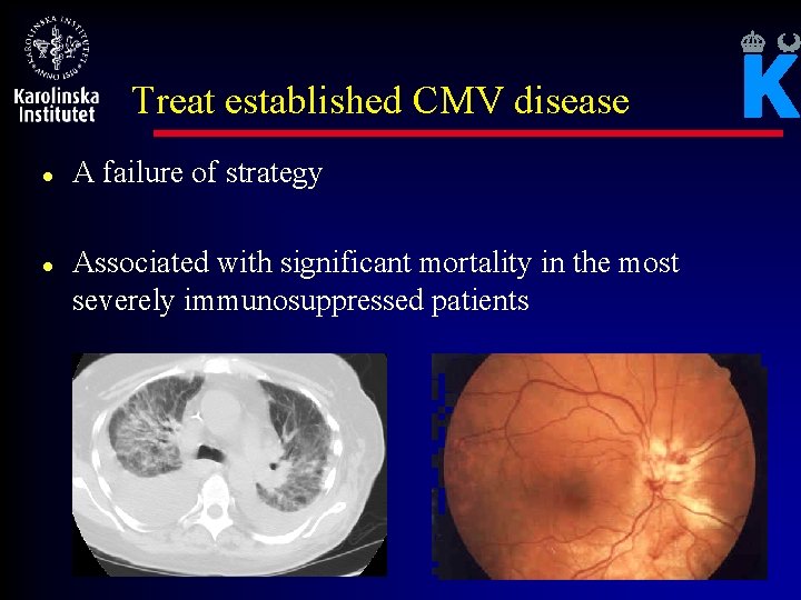 Treat established CMV disease l l A failure of strategy Associated with significant mortality