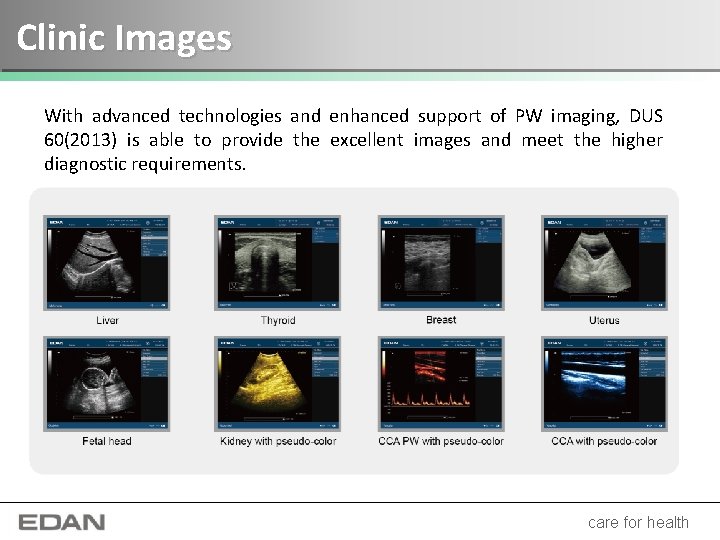 Clinic Images With advanced technologies and enhanced support of PW imaging, DUS 60(2013) is