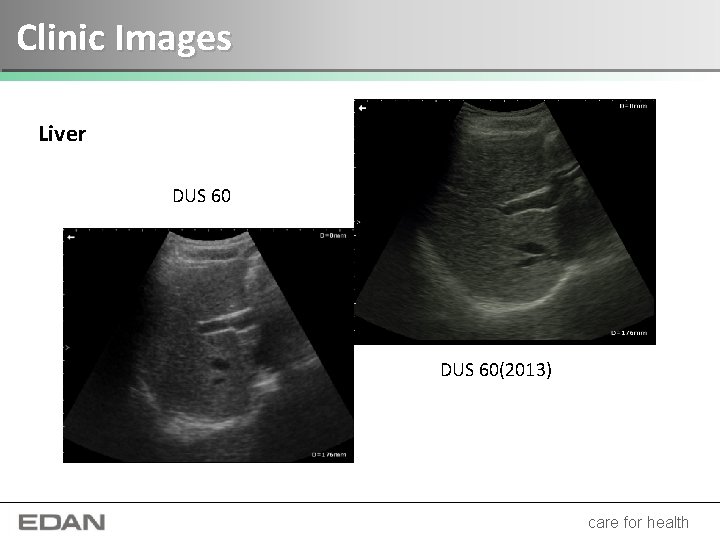 Clinic Images Liver DUS 60(2013) care for health 