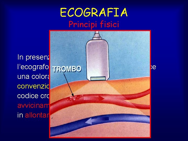 ECOGRAFIA Principi fisici Color-Doppler In presenza di particelle in movimento l’ecografo rileva l’effetto Doppler
