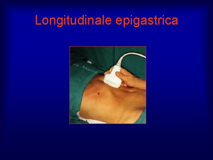 Longitudinale epigastrica 