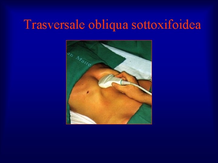 Trasversale obliqua sottoxifoidea 