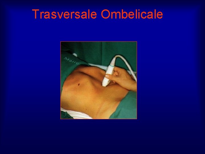 Trasversale Ombelicale 