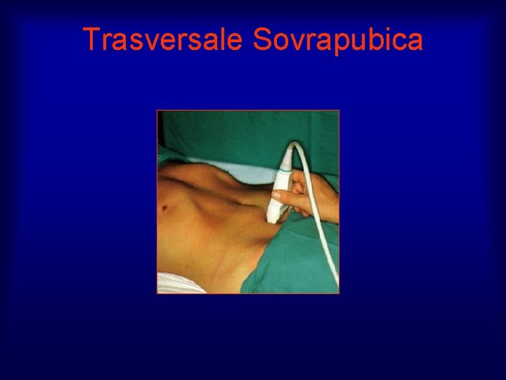 Trasversale Sovrapubica 