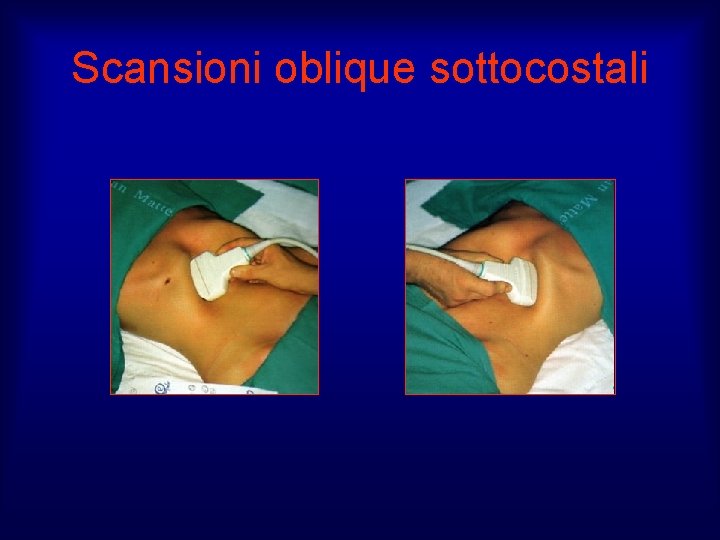 Scansioni oblique sottocostali 