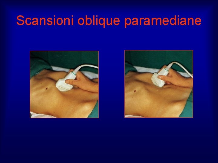 Scansioni oblique paramediane 