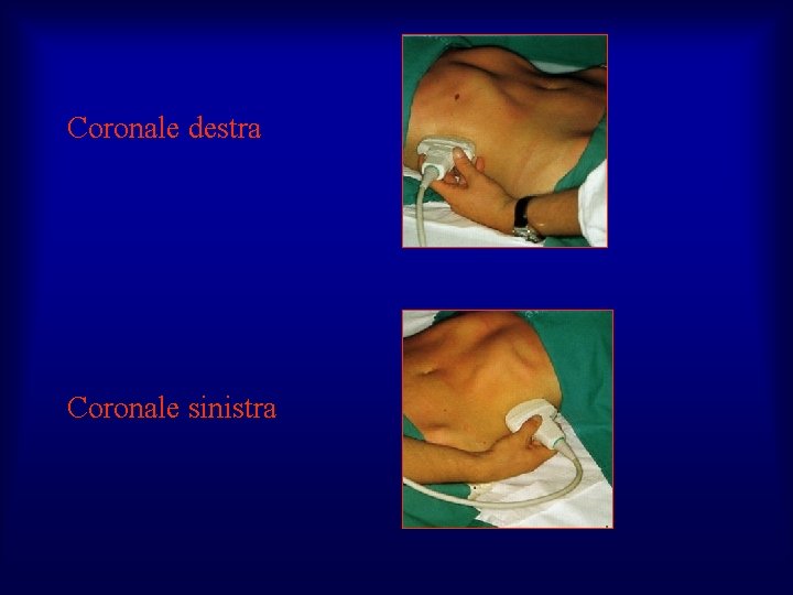 Coronale destra Coronale sinistra 