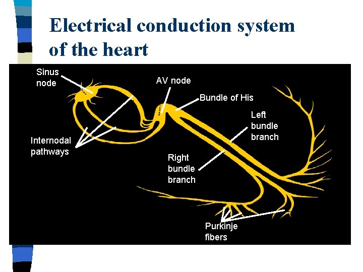 Arrhythmias Cardiac dysrhythmia n Cardiac dysrhythmia arrhytmia n
