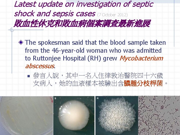 Latest update on investigation of septic shock and sepsis cases (7 October 2012) 敗血性休克和敗血病個案調查最新進展