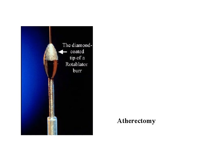 Atherectomy Atherectomy