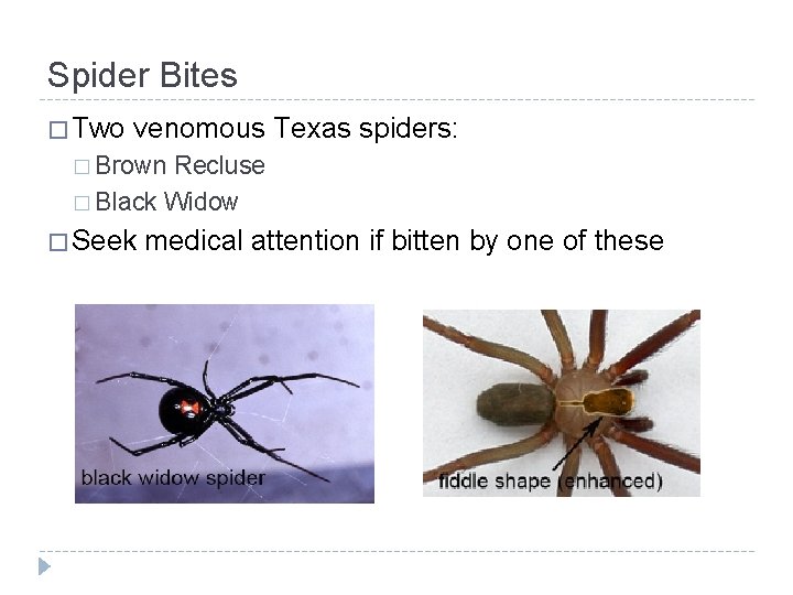 Spider Bites � Two venomous Texas spiders: � Brown Recluse � Black Widow �